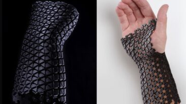 O conceito de elenco médico usa materiais reciclados e métodos sustentáveis